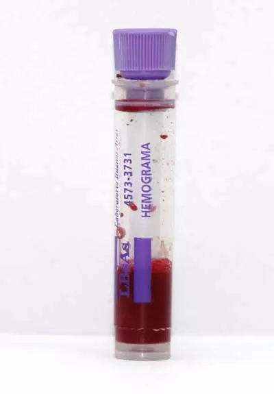 Tubo para HEMOGRAMA (Contiene EDTA 10%)