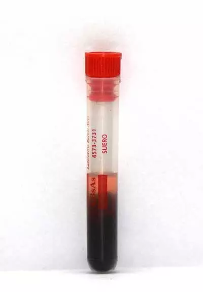 Tubo para SUERO (Seco)